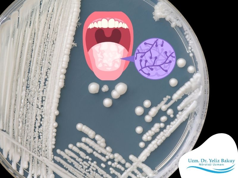 candida-hangi-durumlarda-cogalir-ve-cogalmasi-nelere-yol-acar