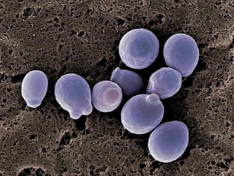 candida-belirtileri-nelerdir