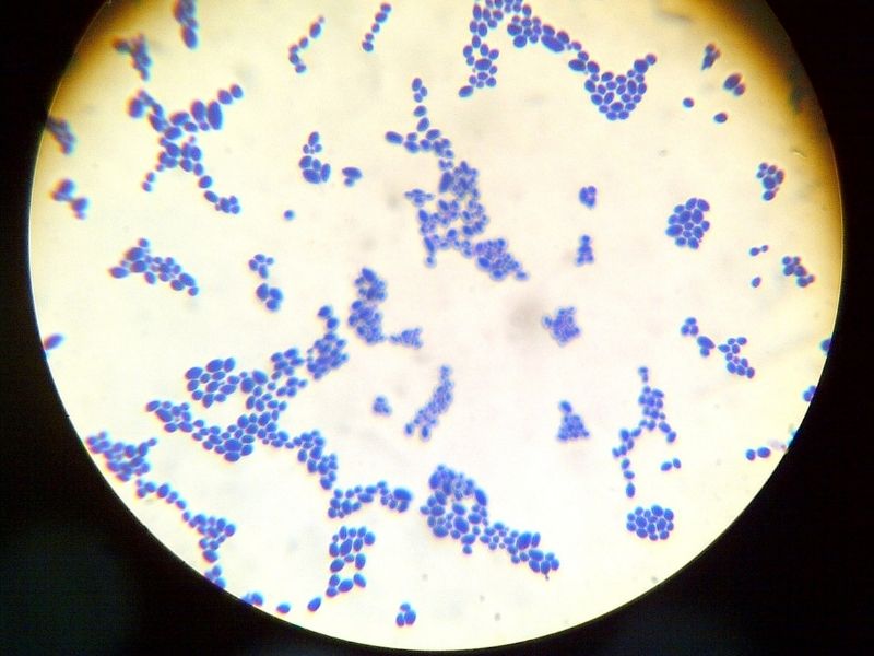 candida-mantari-tedavisi-nasil-olur